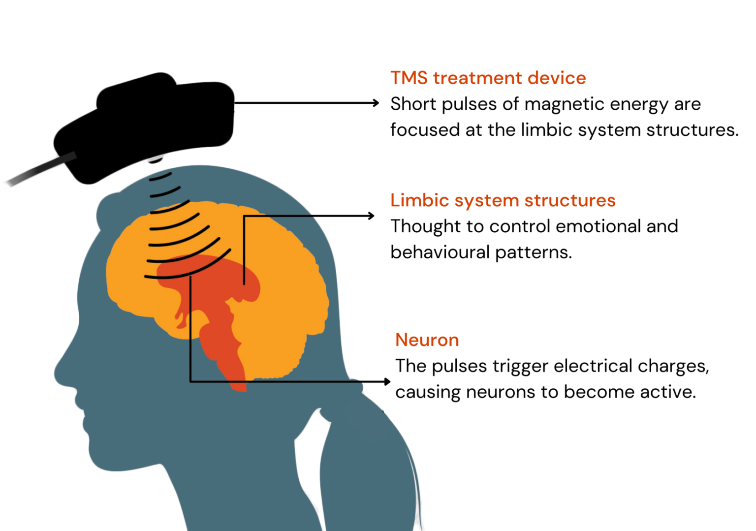 tms stimulation transcranial